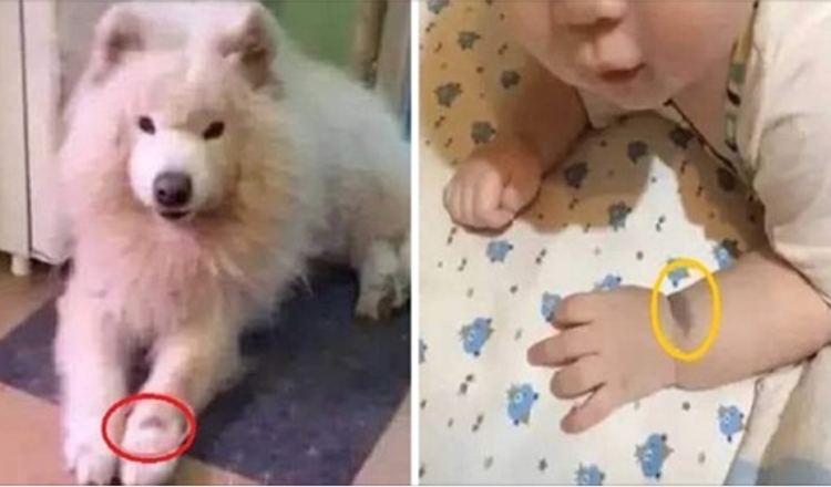 Frau versichert, dass ihr Baby aufgrund eines Muttermals die Reinkarnation ihres Hundes sei